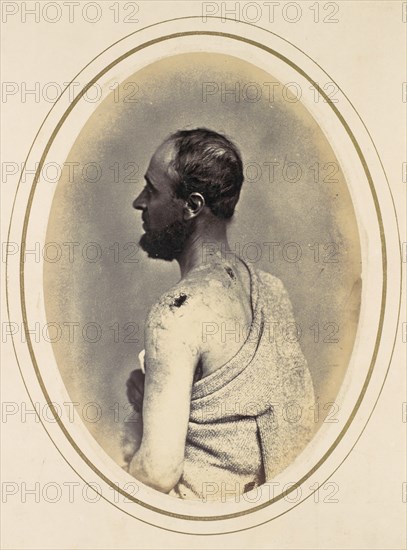 Henry Yon, 1865.