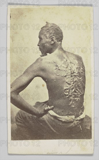 Gordon Under Medical Inspection, 1863. Creator: McPherson & Oliver.