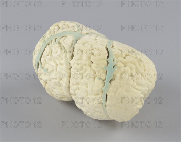 Model of the conjoined brains of Ladan and Laleh Bijani used by Dr. Ben Carson, 2003. Creator: Unknown.