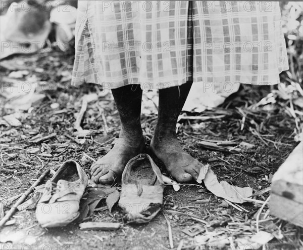 Feet of Negro cotton hoer near Clarksdale, Mississippi, 1937. Creator: Dorothea Lange.