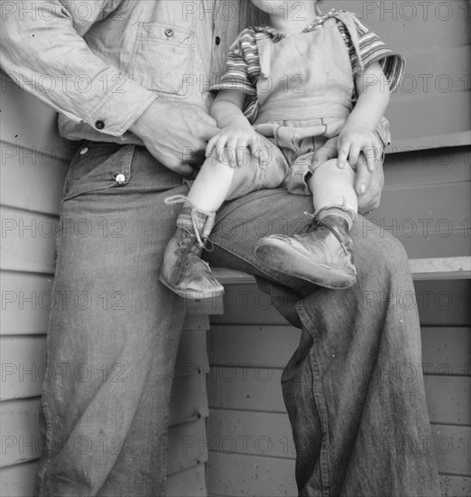 Baby with club feet wearing homemade splints, FSA camp, Tulare County, California, 1939. Creator: Dorothea Lange.