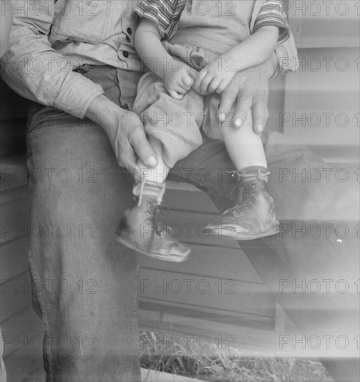 Baby with club feet wearing homemade splints, FSA camp, Tulare County, California, 1939. Creator: Dorothea Lange.