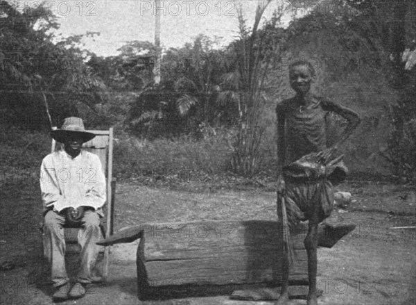 ''Indigene du Congo atteint de la maladie du sommeil; L'Ouest Africain', 1914. Creator: Unknown.