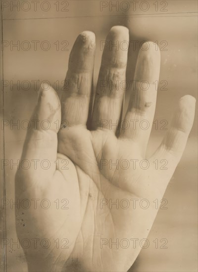 August Strindberg's hand with the inscription "Photographie aufgenommen im Hôpital Saint..., 1895. Creator: Julien Leclercq.