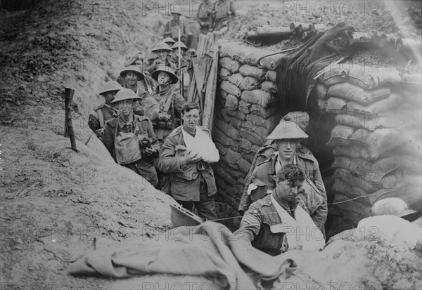 Wounded British in trench, 18 Aug 1918. Creator: Bain News Service.