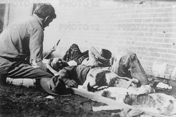 Wounded at Juarez, between c1910 and c1915. Creator: Bain News Service.