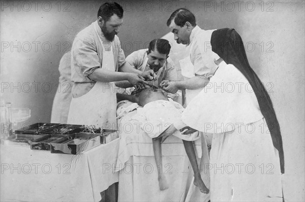 Binding arteries of Hindoo twins after operation, 1902. Creator: Bain News Service.