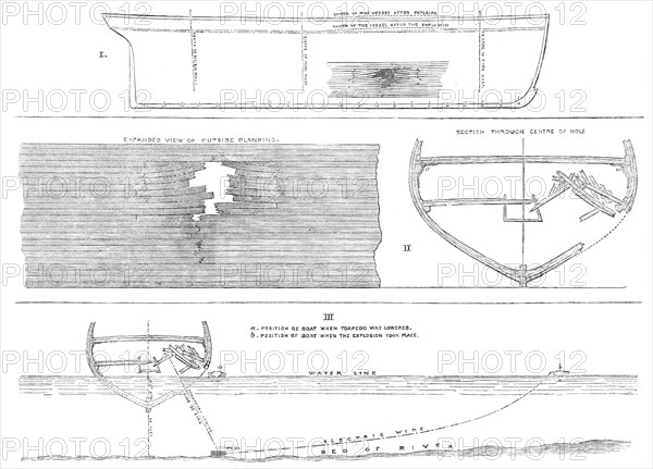 Sections of the hull of H.M.S. Terpsichore, showing effect of the torpedo explosion at Chatham, 1865 Creator: Unknown.