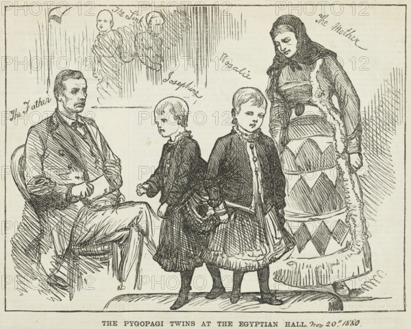 The Pyopagi Twins shown at Egyptian Hall, 1880. Pygopagi twins are conjoined at the buttocks. Josephine and Rosalie were shown at the Egyptian Hall, Piccadilly in 1880.Showmanship was a hard business. People and animals with unusual characteristics were ruthlessly exploited and there was little care for them once they lost their popularity with the audience.