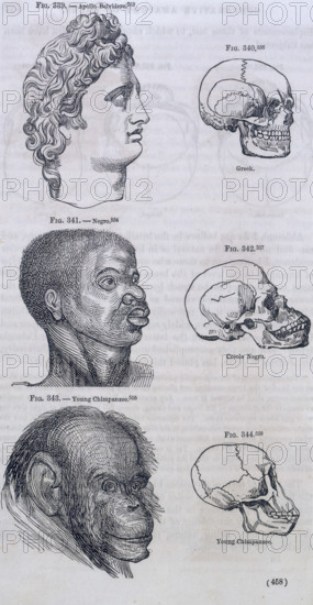 Three faces compared with skulls, 1854. 'Fig. 339. - Apollo Belvidere; Fig. 340. Greek; Fig. 341. - N*gro; Fig. 342. Creole N*gro; Fig. 343. - Young Chimpanzee'. Victorian diagram illustrating the hierarchy of development whereby it was believed that Europeans were more 'advanced' than Africans. The head at the top has been copied from a Greek sculpture of Apollo Belvedere.