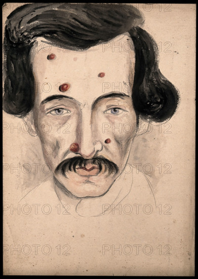 Head of a man with a disease affecting his face, 1800-1899. Creator: Christopher D'Alton.