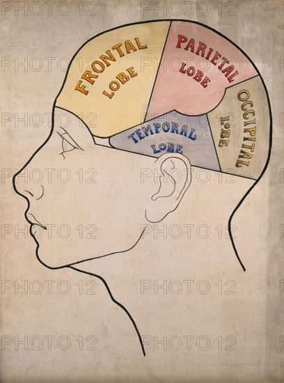 Head of "a backward boy" divided into four cerebral lobes: profile, c1900. Creator: Bernard Hollander.