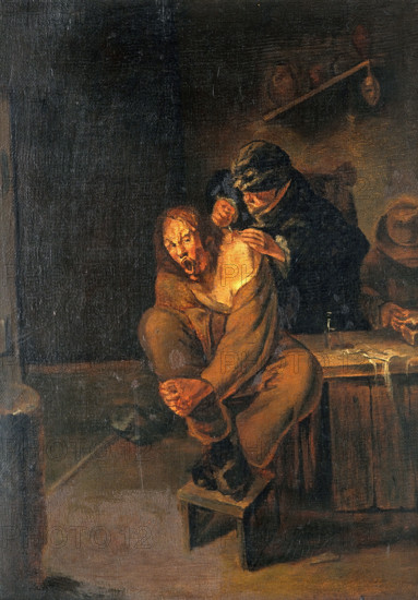 A surgeon operating on a man's shoulder, c1640s. Creator: Unknown.