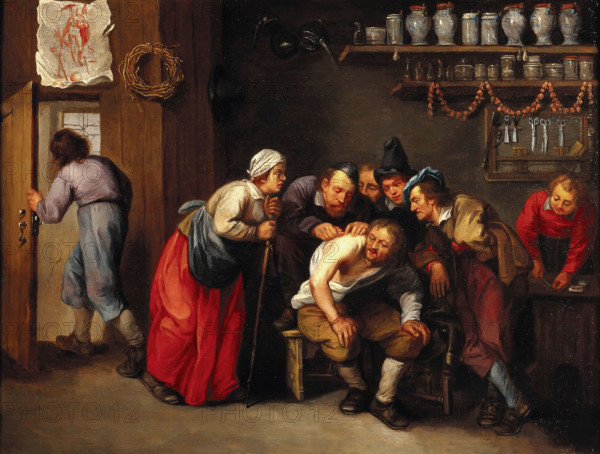 A surgeon removing a plaster from a man's back, with five people looking on, 1647/1667. Creator: Adriaen Rombouts.