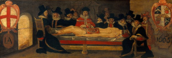 The dissection of a corpse before a company of surgeons, c1665. Creator: Unknown.