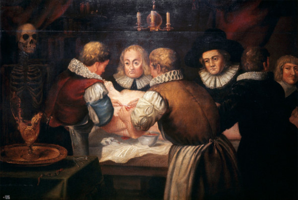 Surgeons performing an operation on a woman's breast in the seventeenth century. Creator: Unknown.