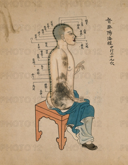 Acupuncture chart with a series of points indicated on the figure of a seated Chinese man, 1700-1799 Creator: Unknown.