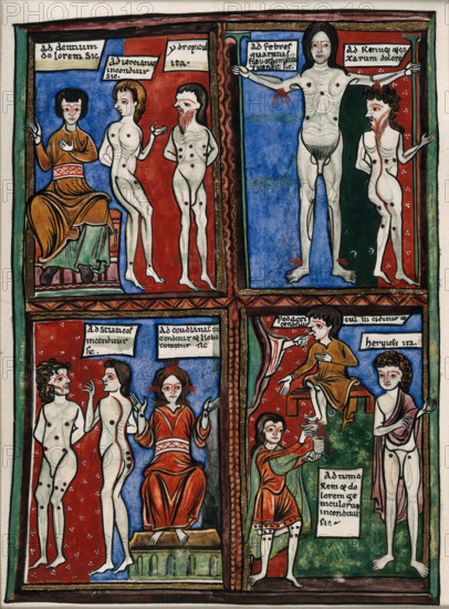 Four vignettes demonstrating different cauterisation points on naked human bodies. Creator: Unknown.