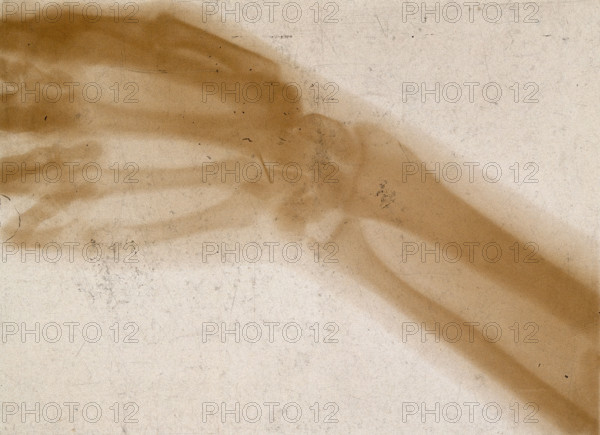 The bones of a hand and wrist, viewed through x-ray, 1896.