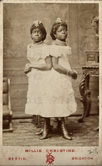 The Millie-Christine sisters, conjoined twins, standing, 1874. Creator: Bertin.