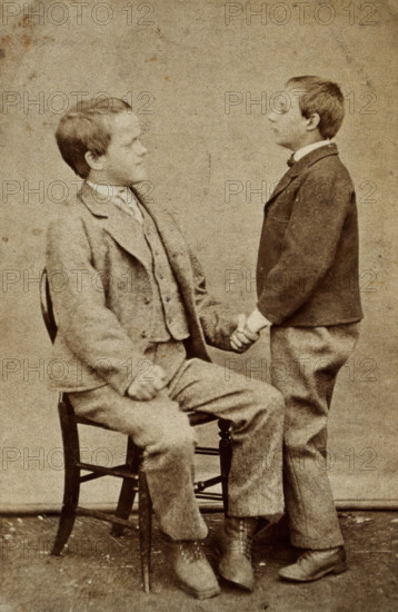 Down's syndrome: in two young men holding hands, one sitting and one standing, c1880s. Creator: Unknown.