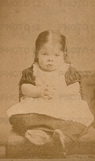 A very young girl, showing signs of mental deficiency, seated with her hands clasped upon her lap. Creator: William Moscrop.