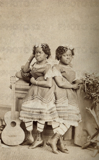 The Millie-Christine sisters, conjoined twins, standing, c1871. Creator: Unknown.