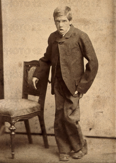A young man, showing signs of mental deficiency, leaning awkwardly..., c1890s. Creator: Davis.