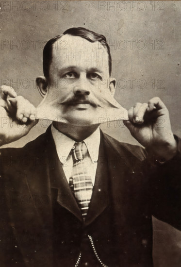 James Morris, stretching the skin on his face. Creator: Unknown.