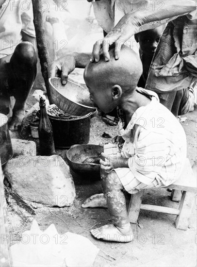 Enfant sous-alimenté au Biafra, 1969