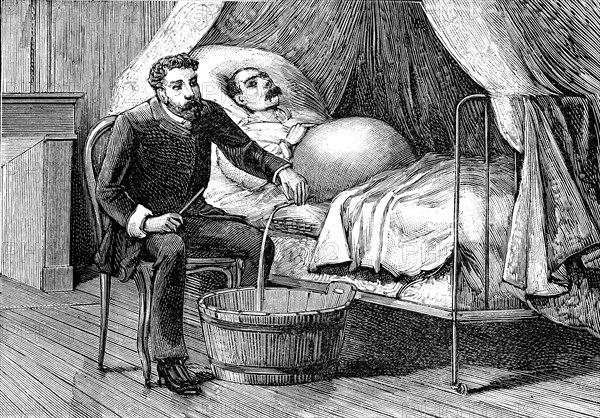 Puncture in cirrhosis ( Liver ). Weekly magazine " Medecine illustree " by
Dr. Gerard. November 1887