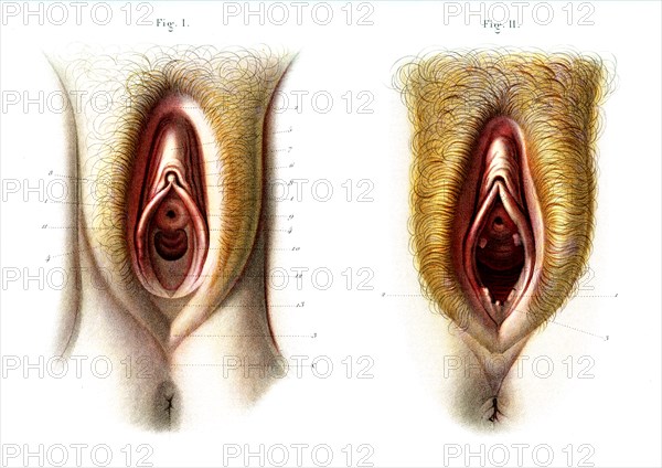 Organes génitaux externes de la femme