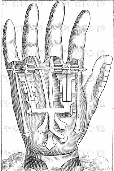 Artificial hand prosthesis