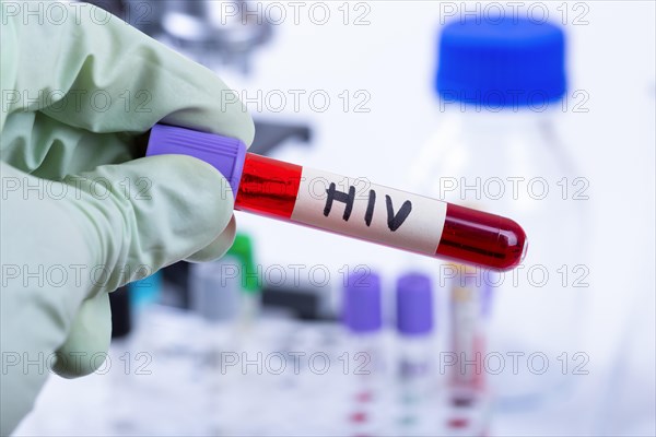 hand holding tube with blood sample for hiv test
