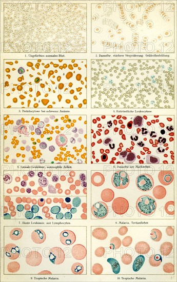 Blood and blood movement, 19th century, blood, blood cell