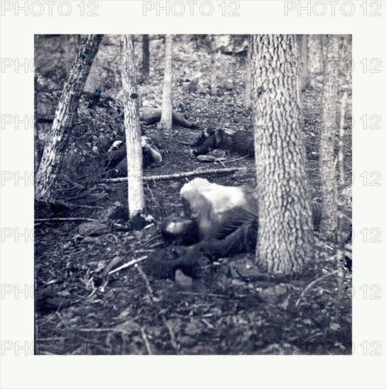 American Civil War: The slaughter pen at Gettysburg, dead soldiers in an area called the slaughter pen to the right of the Union line at the foot of Round Top in Gettysburg in July of 1863. Photo, albumen print, By Alexander Gardner, 1821 1882, Scottish photographer who emigrated to the United States in 1856. From Gardner Photographic Art Gallery, Seventh Street, Washington