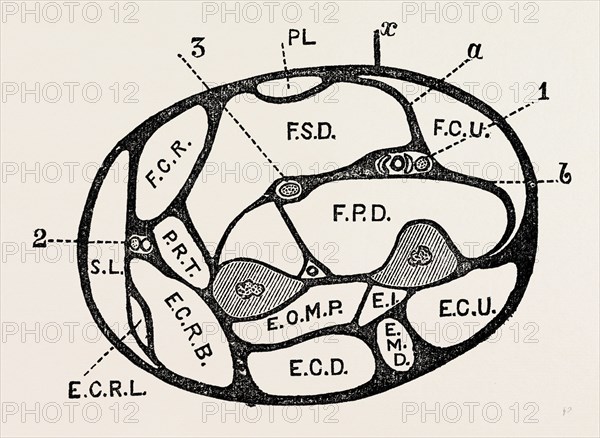 section of the forearm, medical equipment, surgical instrument, history of medicine