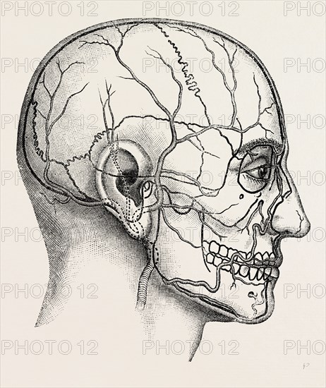 diagram to show the position of the facial, medical equipment, surgical instrument, history of medicine