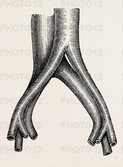 relation of veins, medical equipment, surgical instrument, history of medicine