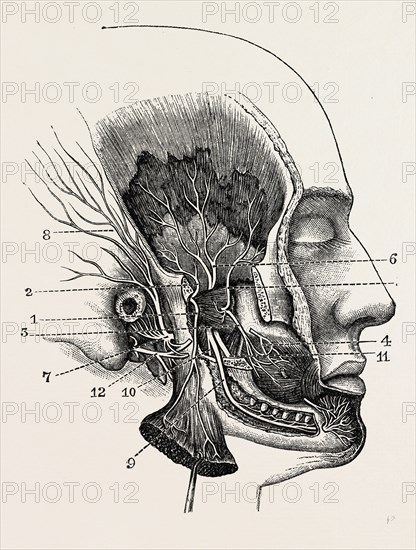 the third division of the fifth nerve, after hirschfeld, medical equipment, surgical instrument, history of medicine