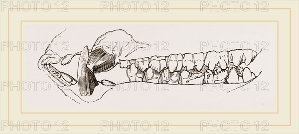 Teeth of the Hog