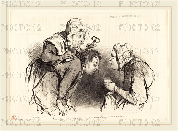 Honoré Daumier (French, 1808-1879), Vous allez voir! Ã§a va arrÃªter le sang..., 1838, lithograph on newsprint