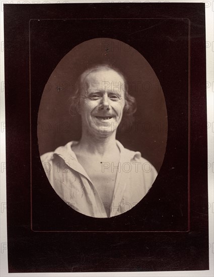 Mécanisme de la physionomie humaine: Figure 32: Rire naturel par la contraction volontaire des deux grands zygomatiques et de l'orbiculaire palpébral inférieur, c. 1856. Guillaume-Benjamin-Amand Duchenne (de Boulogne) (French, 1806-1875), Adrien Tournachon (French, 1825-1903). Albumen print from glass plate negative (printed 1862); image: 15.1 x 11 cm (5 15/16 x 4 5/16 in.); paper: 22.7 x 17 cm (8 15/16 x 6 11/16 in.); mounted: 41 x 27.6 cm (16 1/8 x 10 7/8 in.)