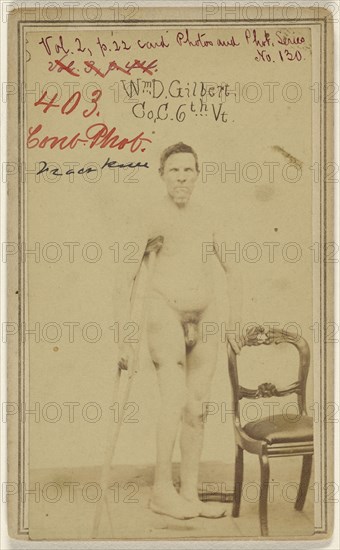 W. D. Gilbert Co, C. 6th Vt. Civil War Victim; American; 1865; Albumen silver print