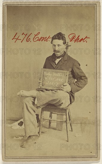 Wesley Walters, Civil War victim; Attributed to William H. Bell, American, 1830 - 1910, about 1864; Albumen silver print