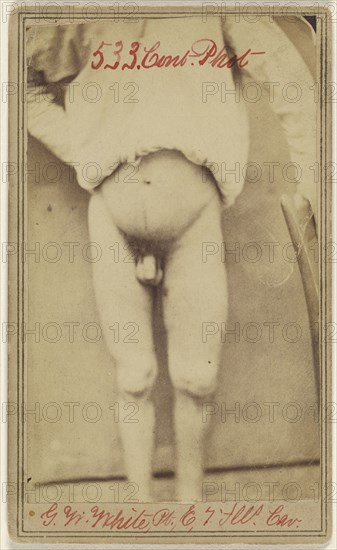 Geo. W. White Pri. Co. E. 7. Ill. Cav. age 25...Civil War victim; Attributed to William H. Bell, American, 1830 - 1910, April