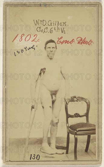 Wm. D. Gilbert Co. C. 6th Vt. Civil War victim; American; 1862 - 1868; Albumen silver print