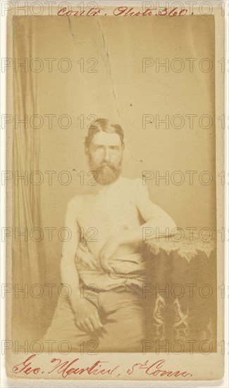 Geo. Martin, 5th Conn. Civil War victim; S. Friedlaender, American, active 1860s, 1864 - 1866; Albumen silver print