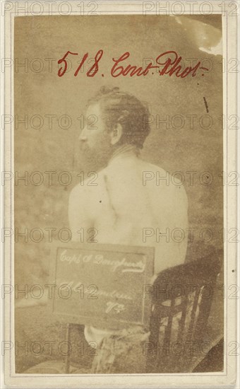 Capt. Dougherty, Alexandria, Va., Civil War victim; American; 1865 - 1870; Albumen silver print