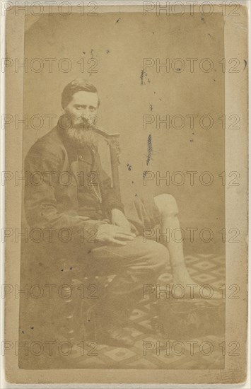 No.5 Case of John Measor U.S.V. Excision of the Tibia; American; 1864 - 1870; Albumen silver print